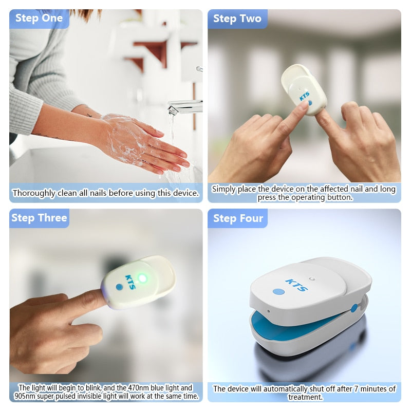 Fungal Nail Treatment Laser Device For Nail Fungus - onestopmegamall23